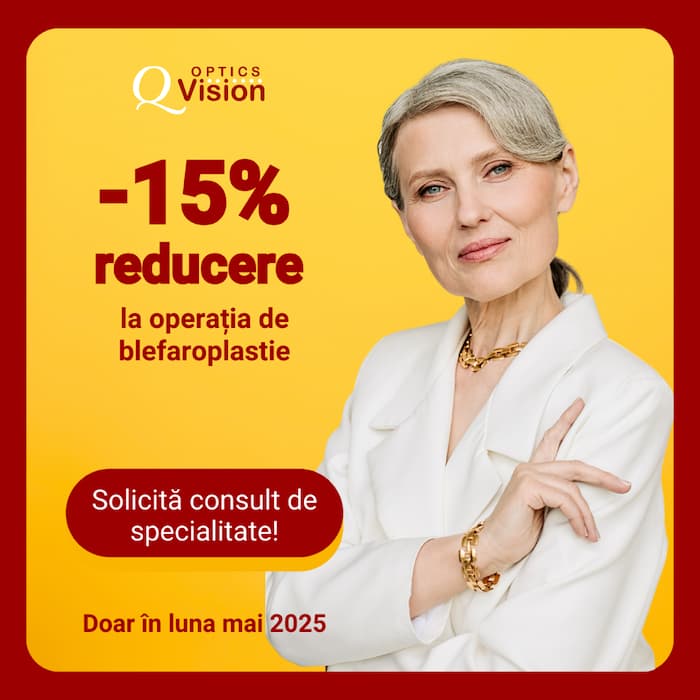 consultatie oftalmologie cluj